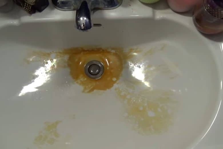 how to remove yellow stains from bathroom sink
