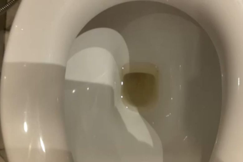 Why is my toilet water yellow